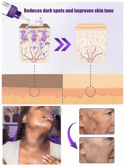 Highly effective whitening and spot-lightening cream